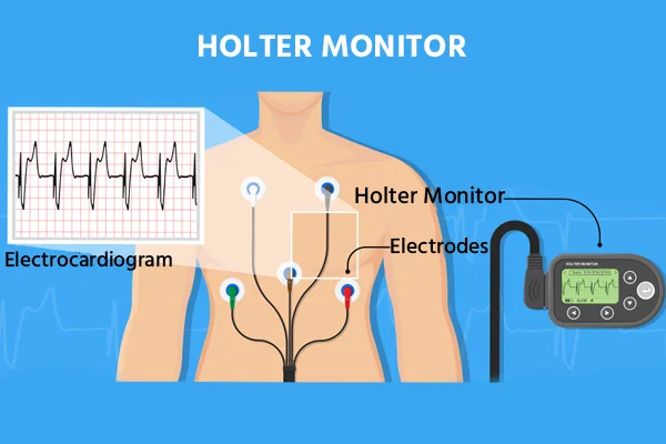 Holter Monitoring for Rent and Sale